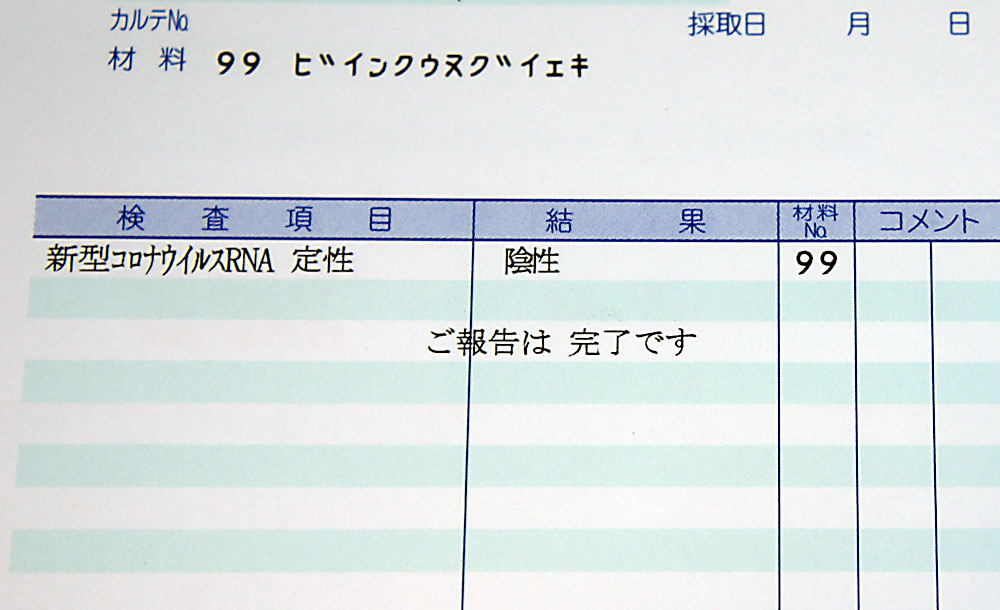 メシル コロナ カモスタット カモスタット（フォイパン）は市販、通販、個人輸入で買えるか？